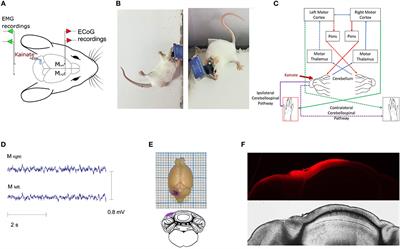 Reduced Interhemispheric Coherence in Cerebellar Kainic Acid-Induced Lateralized Dystonia